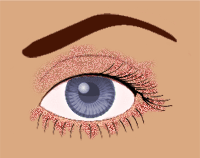 Description: Blepharitis can appear as greasy flakes or scales around the base of the eyelashes.