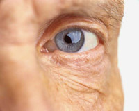 Description: The majority of people over the age of 65 experience some symptoms of dry eyes.